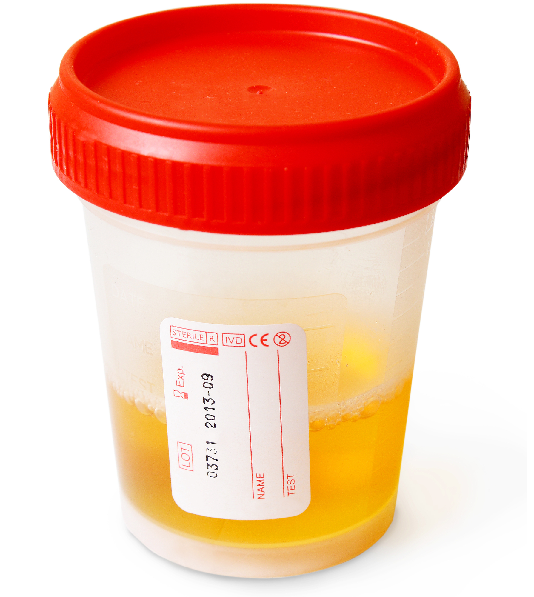 Close-up of a plastic urine sample container.