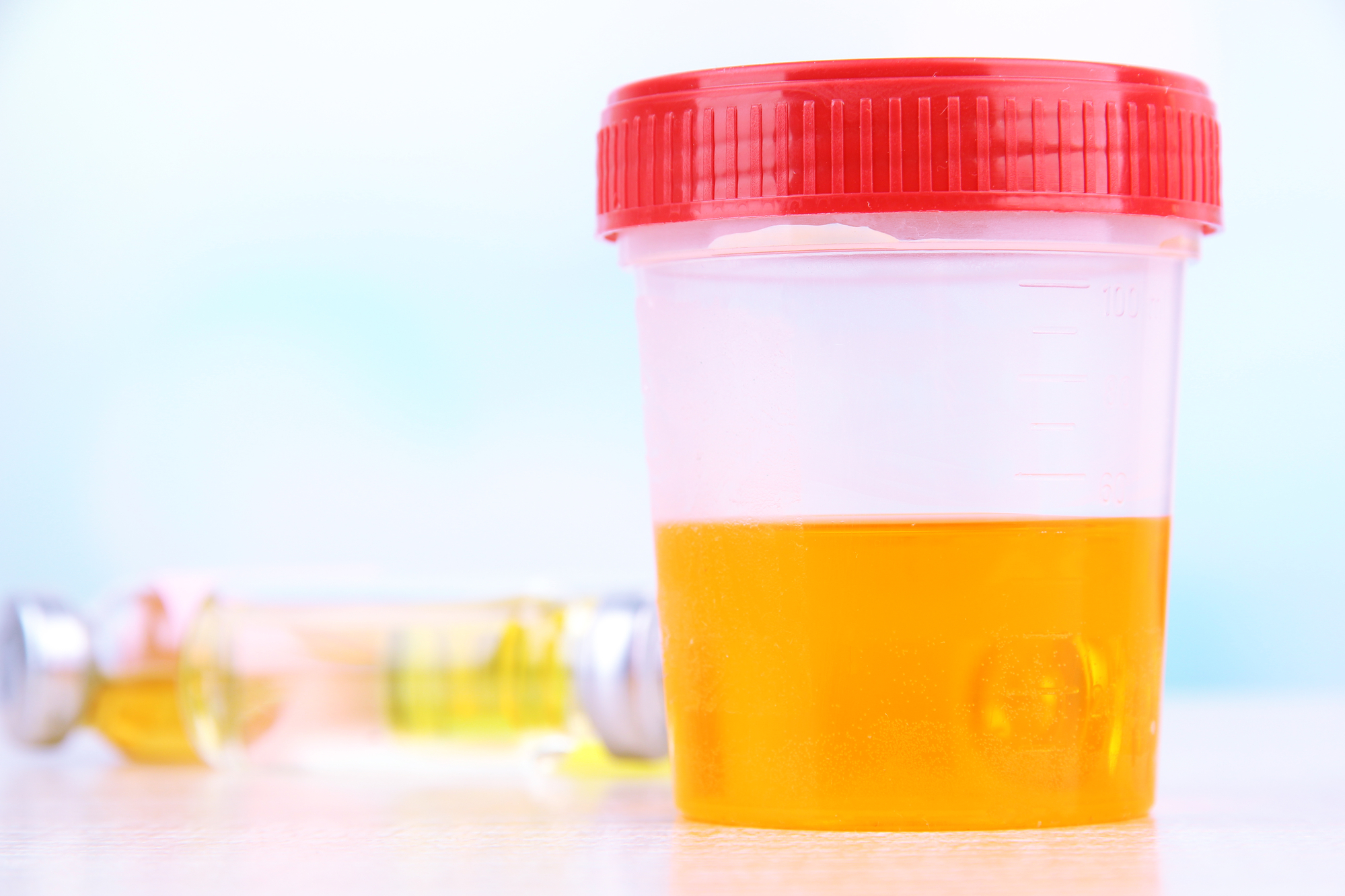 Close-up of a plastic cup with a red lid containing a urine sample.