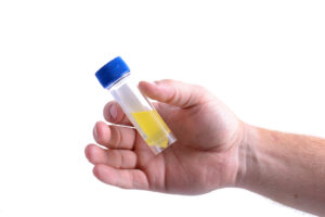 Close-up of a person’s hand holding a small plastic fluid sample container.